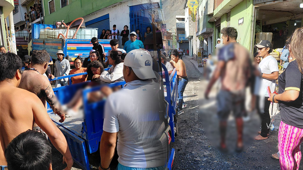 Deflagración en Secocha deja tres heridos de gravedad