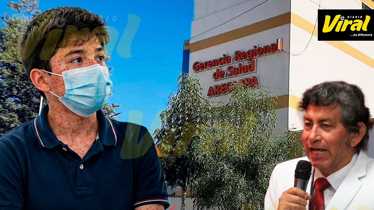 Arequipa suma nueve casos de sarampión